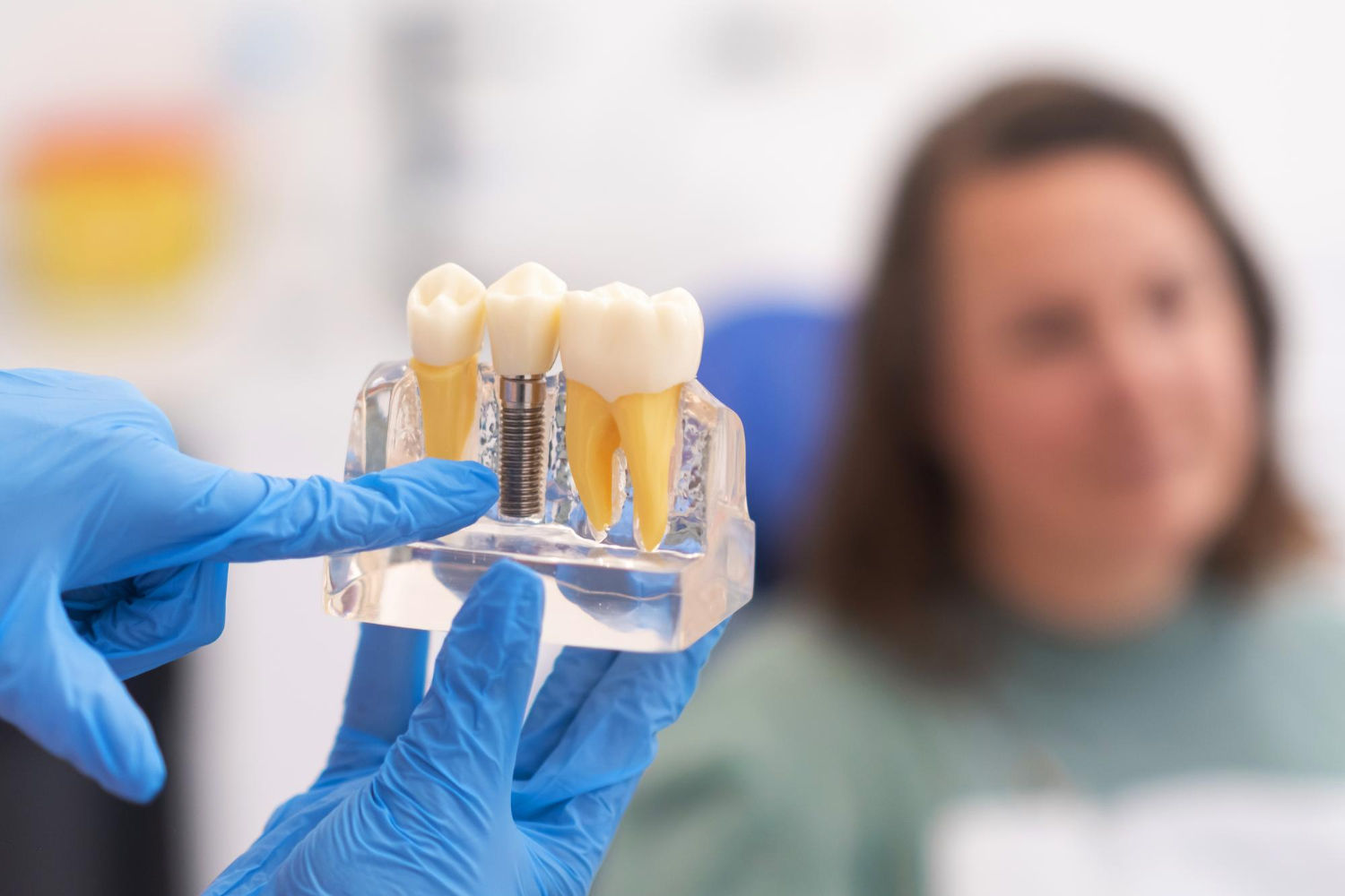 dlaczego warto zdecydować się na implant
